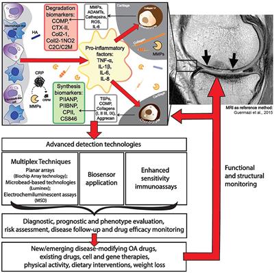 Emerging Technologies and Platforms for the Immunodetection of Multiple Biochemical Markers in Osteoarthritis Research and Therapy